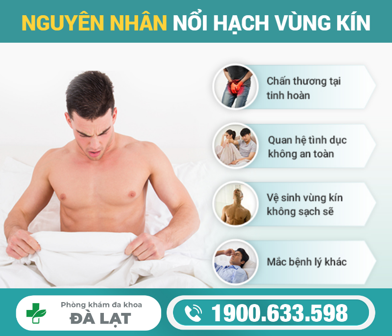 Hình ảnh minh họa